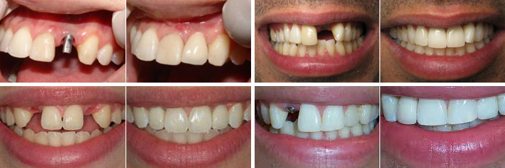 before-after