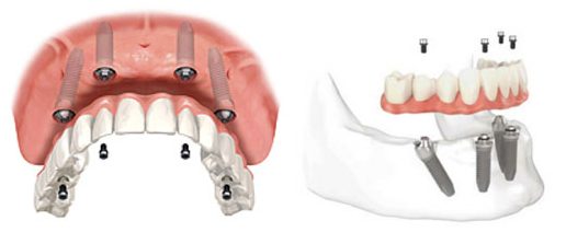 teeth-day-e1461668448429